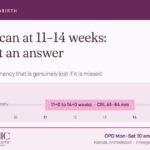 NT scan at 11 to 14 weeks — the window, crown-rump length 45 to 84 mm, Cosmic Women’s Hospital, Naroda, Ahmedabad